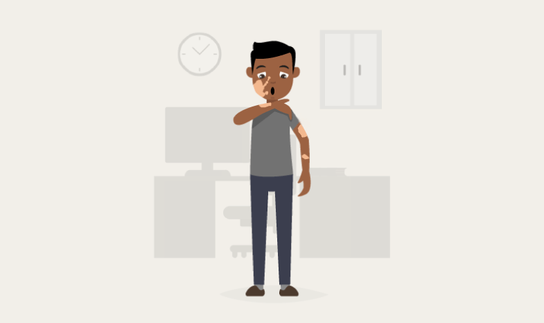 Vitiligo: Sintomas e como tratar