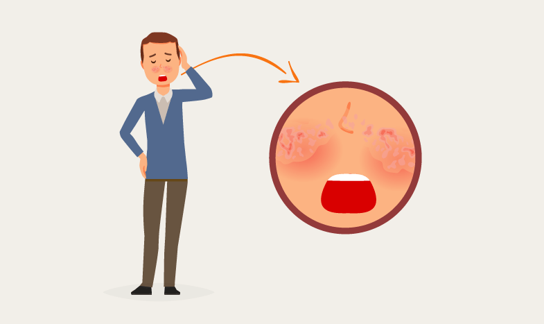 Rosácea: Sintomas, causas e tratamentos