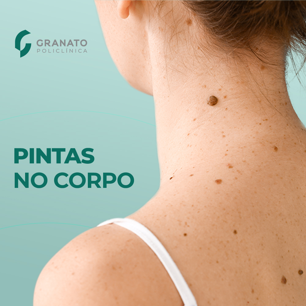 Como saber se uma pinta indica câncer?